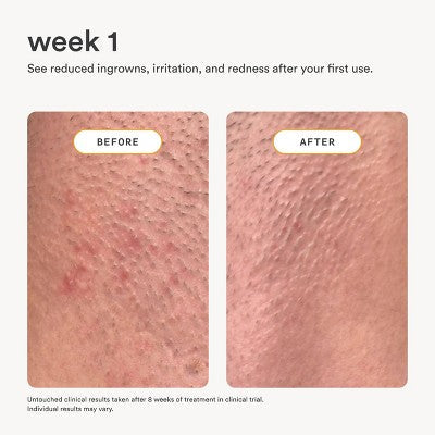 Nood After Care Serum 3.3 fl oz - New