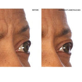 SiO Beauty Super-Lift Pack Brow Eye Smile Patches - New