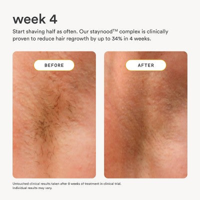 Nood After Care Serum 3.3 fl oz - New